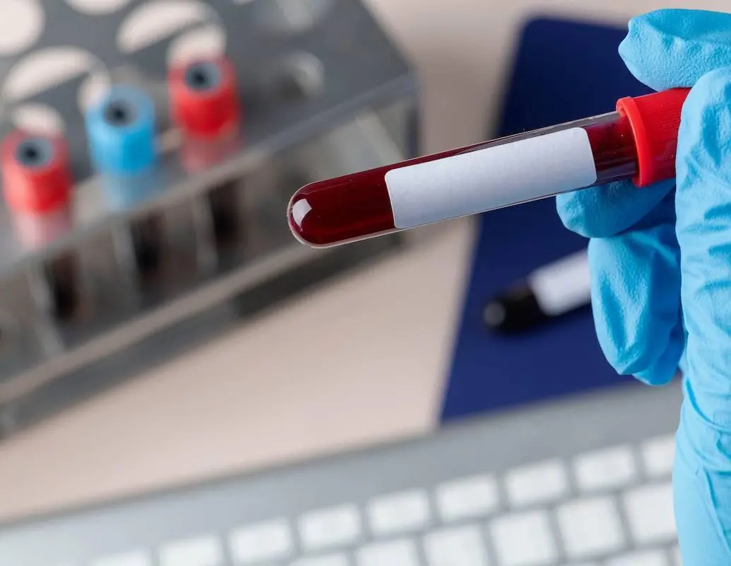 El prototipo de test desarrollado permite detectar en sangre el biomarcador sAXL, asociado al cáncer de páncreas, mediante una tira reactiva de bajo coste. FOTO Agencia Sinc