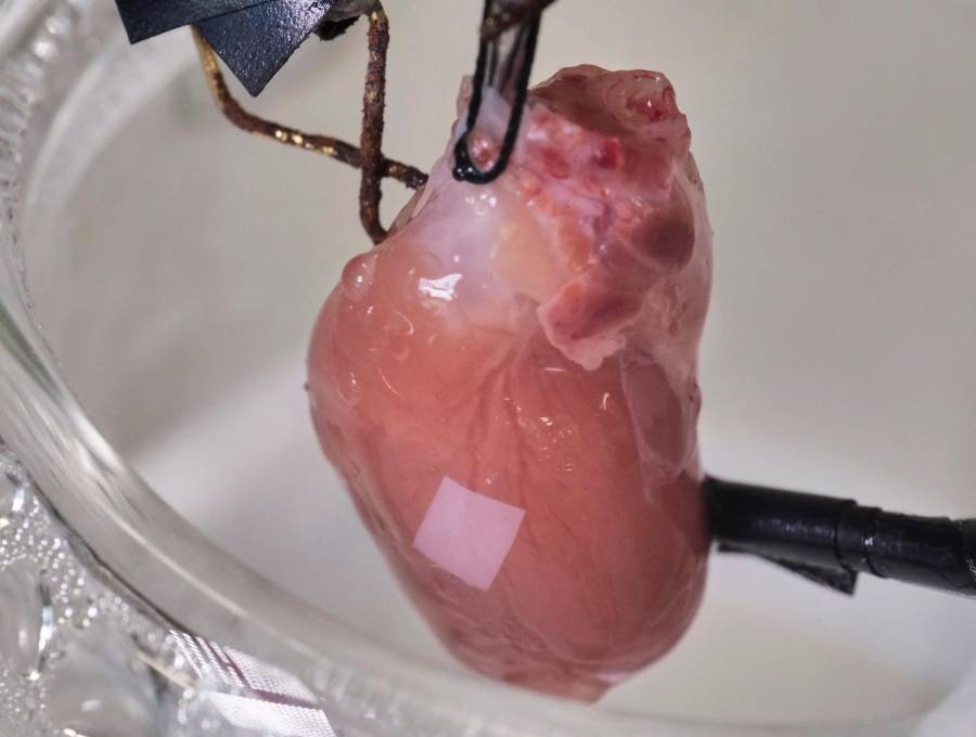 El bioparche se adhiere al corazón e incluso comienzan a crecer células del tejido alrededor de él. FOTO: Cortesía UPB 