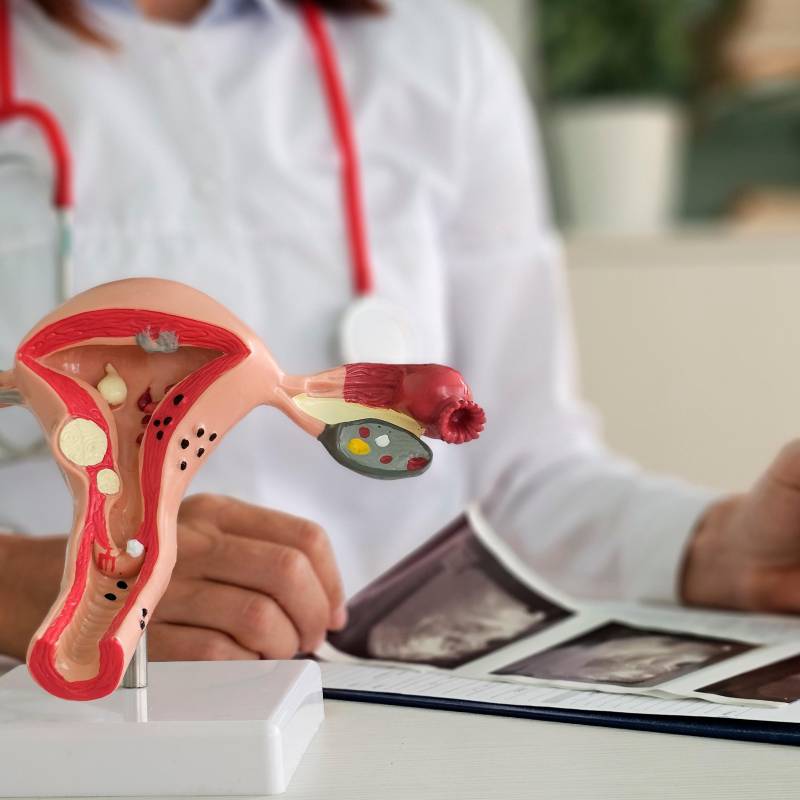 En 1860 se documentó el primer caso de endometriosis en el mundo. Foto Getty.