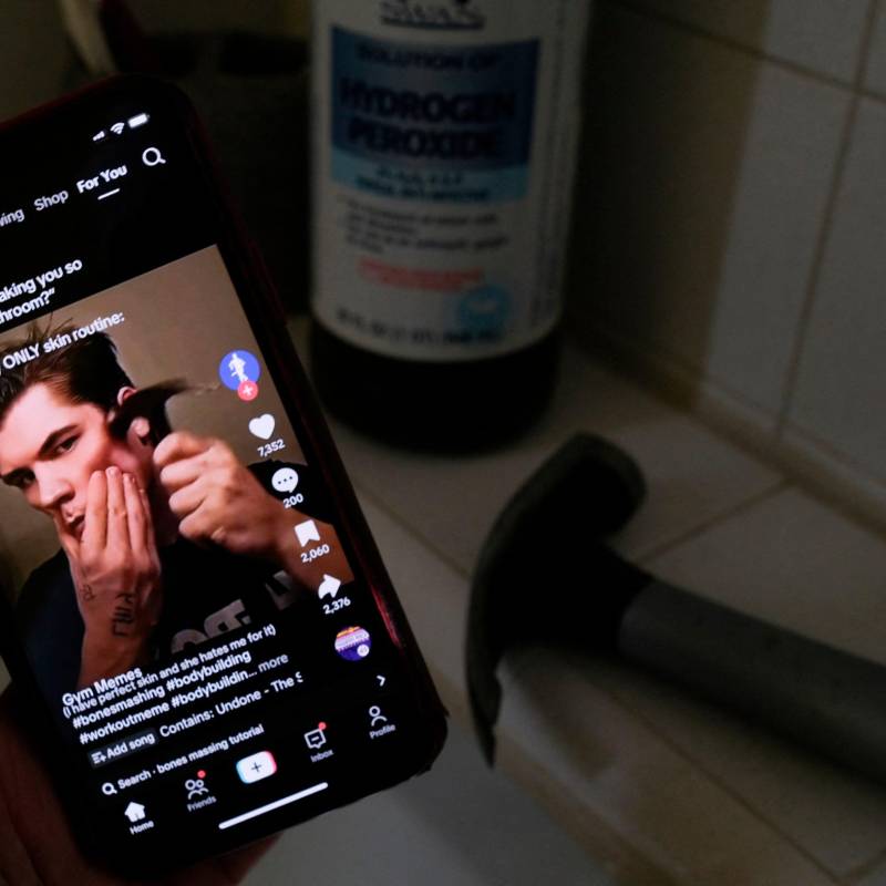 Hombres que hasta se golpean la cara con martillos para lograr al apariencia ideal, hasta ese punto han llegado los ideales de belleza impulsados por el looksmaxing. FOTO AFP