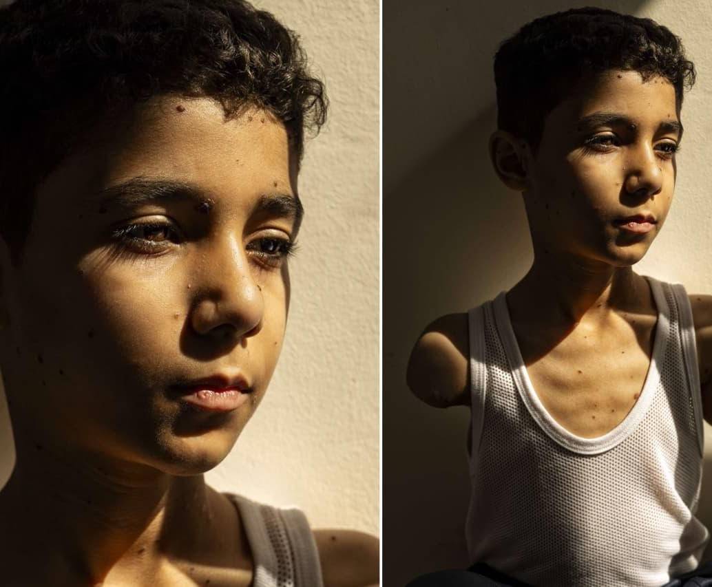 Esta es la fotografía de Mahmoud Ajjour que ganó el World Press Photo este 2025. FOTO: World Press Photo -Samar Abu Elouf 