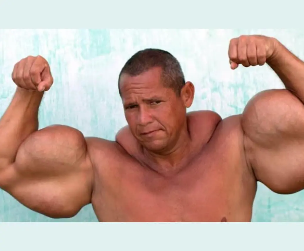 ¿Qué se sabe de la muerte de Arlindo de Souza, conocido como el “Popeye brasileño”? FOTO: Captura de video <i>- Truly - B TV Barcroft TV</i>