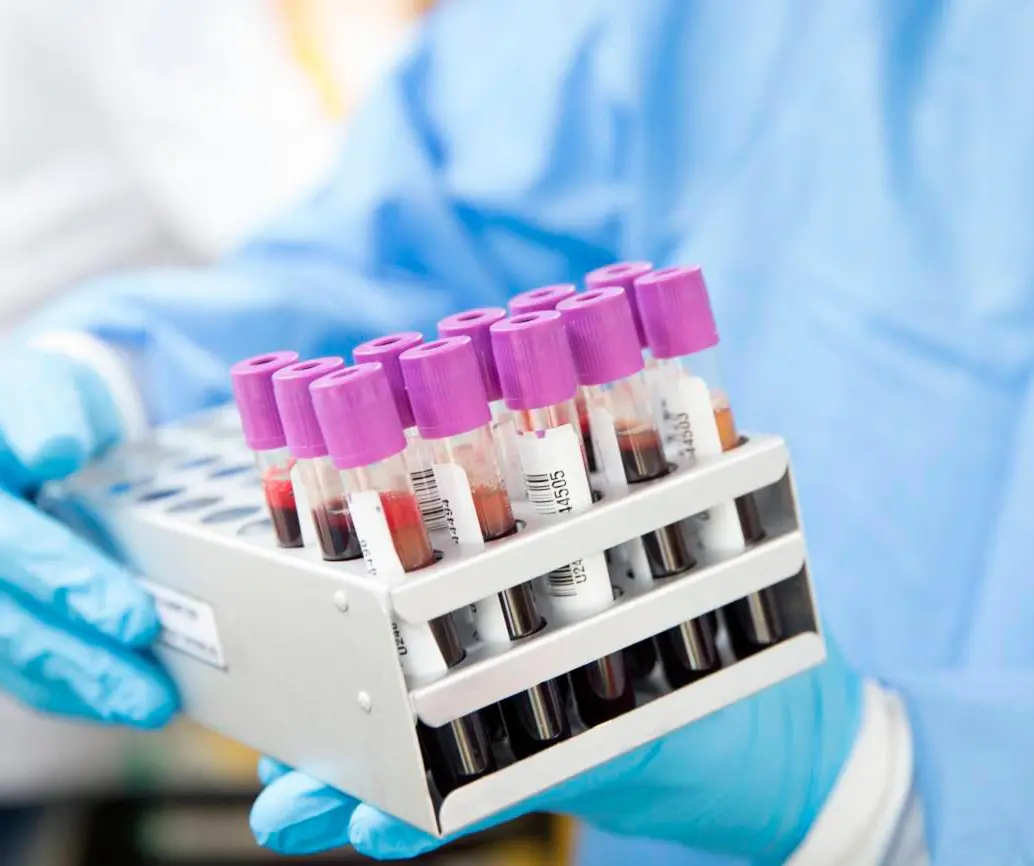 El virus del VIH puede permanecer oculto en focos celulares repartidos por tejidos del organismo incluso cuando los retrovirales lo mantienen bajo control. Foto Agencia Sinc