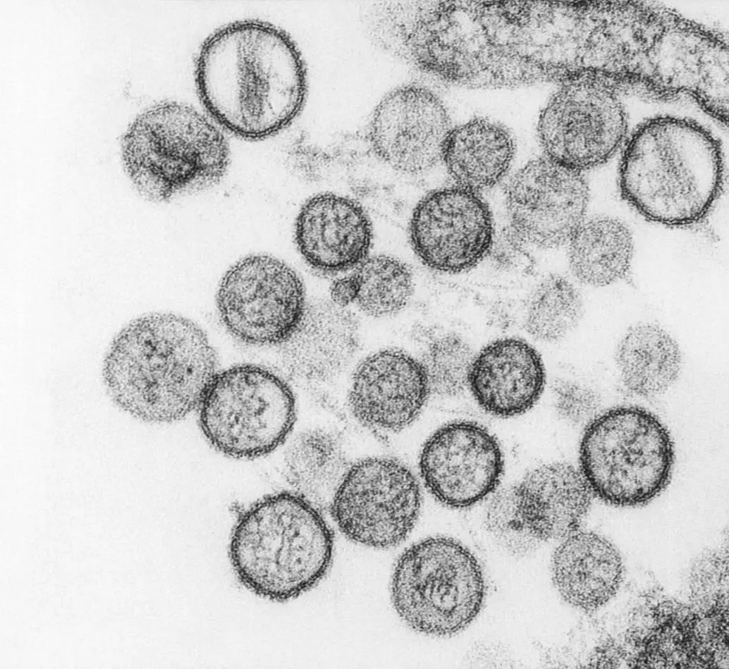 Hantavirus visto a microscopía. FOTO agencia Sinc/CDC/Brian W.J. Mahy, PhD; Luanne H. Elliott, M.S.