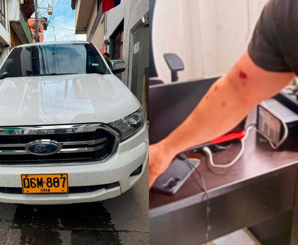 En la camioneta (izq.) se movilizaba el comandante operativo de la Policía Antioquia, coronel Gerson Bedoya Piraquive, junto con tres uniformados por Cañasgordas cuando fueron víctimas de un ataque por parte del Clan del Golfo. El alto oficia sufrió una herida en su brazo (der.). FOTOS: CORTESÍA