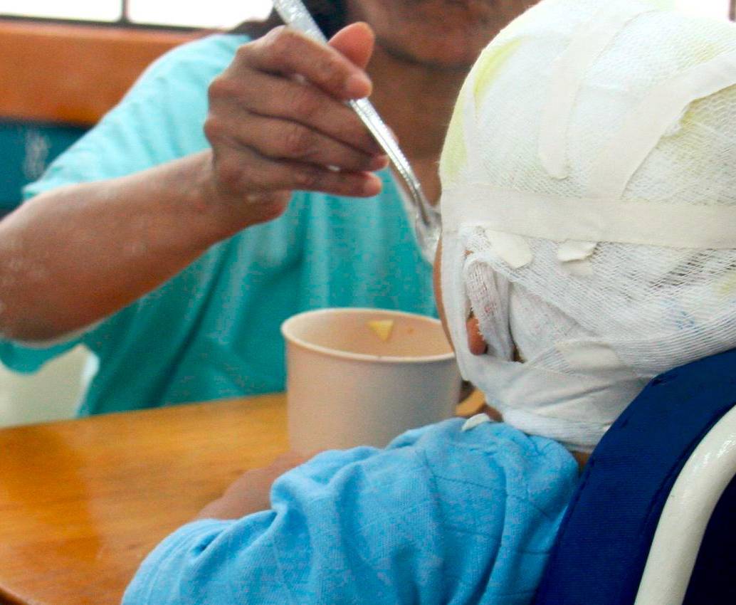 El menor fue atendido durante varios días en el Hospital San Vicente Fundación, de Medellín, donde falleció por la gravedad de las quemaduras. FOTO: ARCHIVO