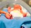 La Corte Constitucional emitió una sentencia en la que ordenó que la prueba del talón sea cubierto por el sistema de salud. FOTO COLPRENSA