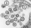 Hantavirus visto a microscopía. FOTO agencia Sinc/CDC/Brian W.J. Mahy, PhD; Luanne H. Elliott, M.S.