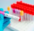 El virus de inmunodeficiencia humana (VIH) es una enfermedad que ataca al sistema inmunitario del cuerpo y no tiene cura. FOTO: Getty