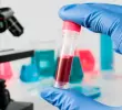 En 2024 Colombia registró más de 6,2 millones de personas identificadas con hipertensión y cerca de 2,3 millones con diabetes. FOTO SSTOCK