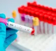 Se estima que 9 millones de personas en todo el mundo carecen de acceso a tratamientos vitales contra el VIH, y las nuevas infecciones siguen aumentando en varias regiones. FOTO GETTY