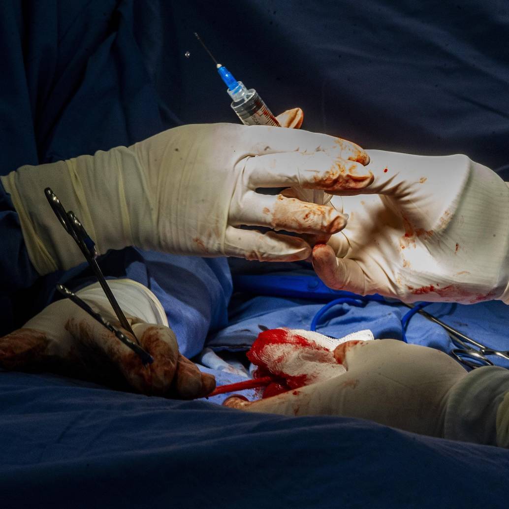 Imagen de referencia de una cirugía de transplante de órganos. FOTO: JULIO CÉSAR ECHEVERRI