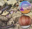 La fragata portuguesa fue avistada en las playas de Necoclí. En detalle, su apariencia y las lesiones que provoca su contacto. Fotos: Corporurabá, CVS y cortesía.