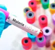 La malaria es una enfermedad tropical transmitida principalmente por la picadura de un mosquito. FOTO SSTOCK