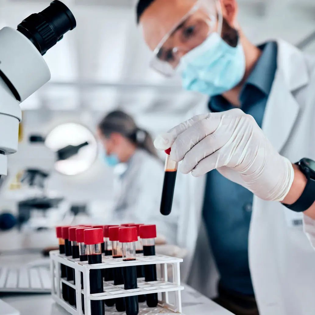 El prototipo de test desarrollado permite detectar en sangre el biomarcador sAXL, asociado al cáncer de páncreas, mediante una tira reactiva de bajo coste. FOTO: GETTY