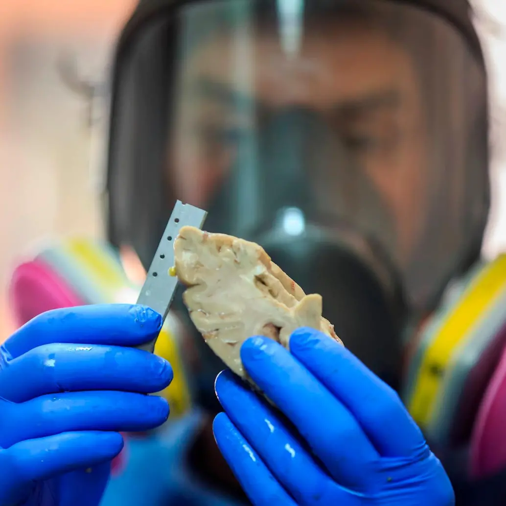 Cada año hay 10 millones de casos nuevos de demencia en todo el mundo. FOTO Camilo Suárez