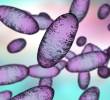 La peste neumónica es la forma más peligrosa de la peste, una enfermedad infecciosa causada por la bacteria <i>Yersinia pestis</i> que puede transmitirse por vía aérea de persona a persona y matar en menos de 24 horas sin tratamiento. FOTO Science Photo Library via AFP