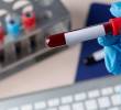 El prototipo de test desarrollado permite detectar en sangre el biomarcador sAXL, asociado al cáncer de páncreas, mediante una tira reactiva de bajo coste. FOTO Agencia Sinc