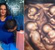María Tapia y Jonatan Zapa esperan a cuatrillizos varones que serían genéticamente idénticos. FOTOS: Tomada de Tiktok/Cuatrillizos Caucasia