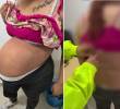 Narcoembarazo: sorprendieron a mujer con más de 5 mil dosis de cocaína camuflada en el vientre