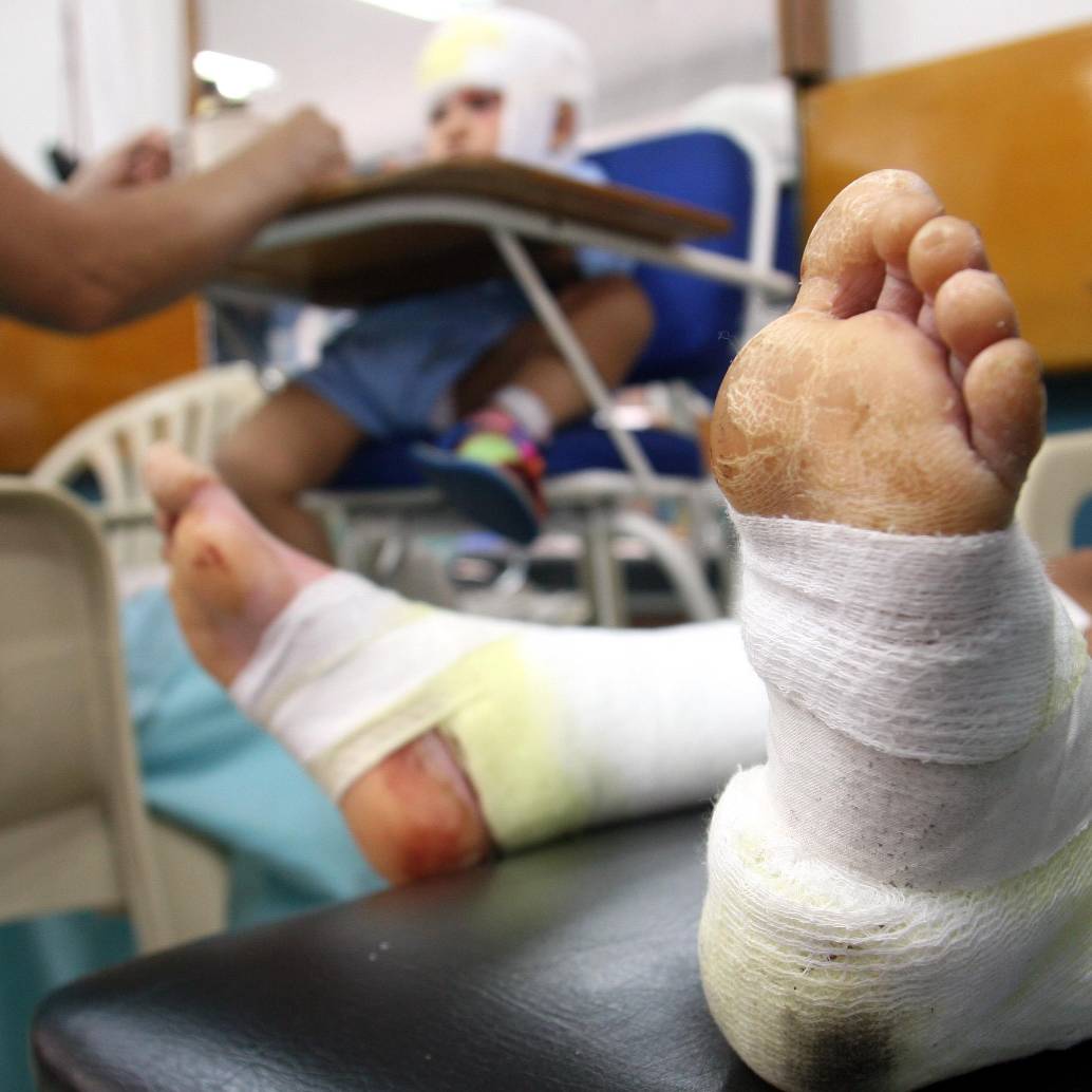 Durante el último año, por lo menos 20 menores de edad han resultado lesionados por el uso de pólvora en Antioquia. FOTO: Donaldo Zuluaga Velilla. Archivo El Colombiano