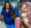 María Tapia y Jonatan Zapa esperan cuatrillizos idénticos. Foto: tomada de TikTok @cuatrillizoscaucasia