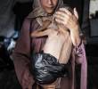 Muhammad Zakariya Ayyoub al-Matouq, un niño de un año y medio en la ciudad de Gaza, enfrenta una desnutrición que pone en peligro su vida a medida que la situación humanitaria empeora debido a los continuos ataques y bloqueos israelíes, el 21 de julio de 2025. Tras haber bajado de 9 a 6 kilos, lucha por sobrevivir en una tienda de campaña en la ciudad de Gaza, donde escasean leche, alimentos y otros artículos de primera necesidad. Foto: Ahmed Jihad Ibrahim Al-arini/Anadolu via Getty Images
