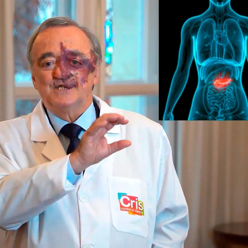 El estudio fue realizado por el Grupo de Oncología Experimental del Centro Nacional de Investigaciones Oncológicas (CNIO) de España. Foto captura de video y Depositphotos.