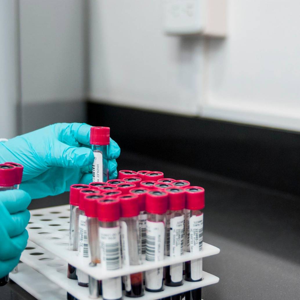 La nueva prueba en sangre podría facilitar el diagnóstico temprano de distintos tipos de cáncer. FOTO Pixabay