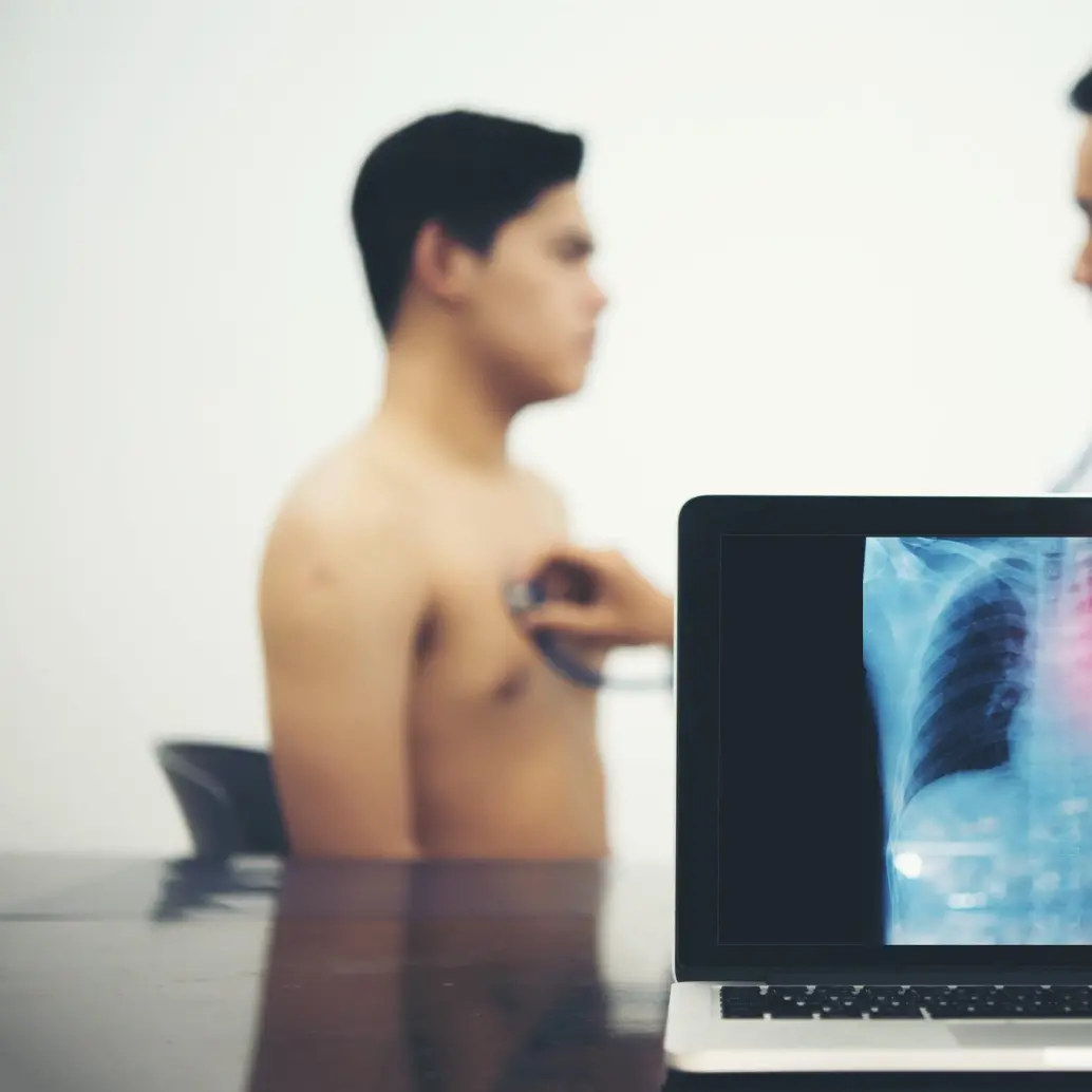 La tuberculosis sigue siendo un reto de salud pública, con miles de casos reportados en Colombia. Foto: Getty
