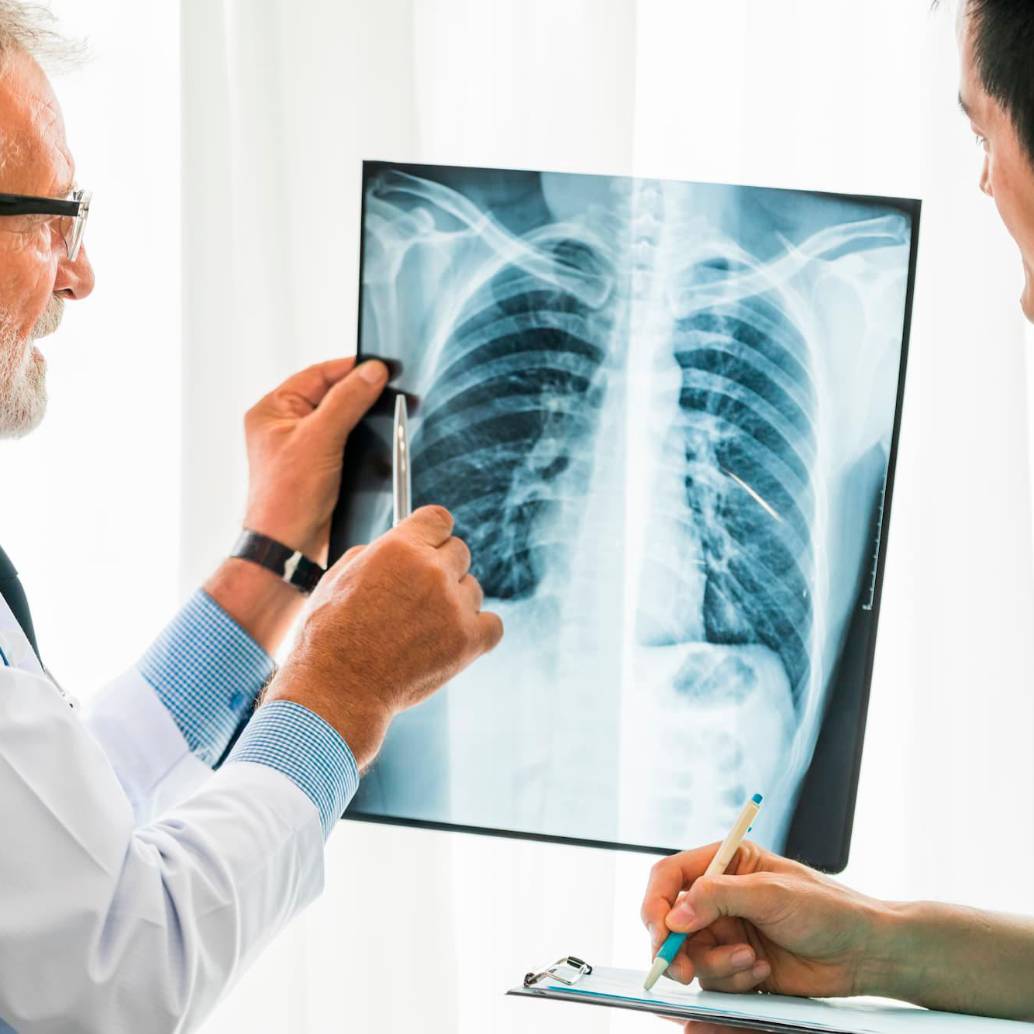 Las principales enfermedades cardiovasculares son la cardiopatía isquémica, la hemorragia intracerebral, el ictus isquémico y la cardiopatía hipertensiva. FOTO: Getty