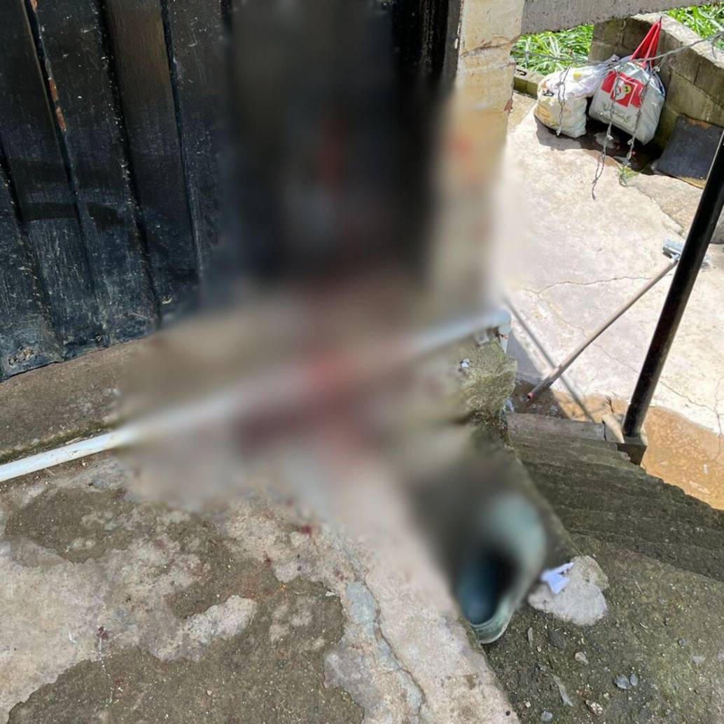 Escena donde quedó tendido “Checho” al dispararle presuntamente alias “Manchas”, ambos fallecieron en el centro hospitalario. FOTO: Andrés Felipe Osorio García