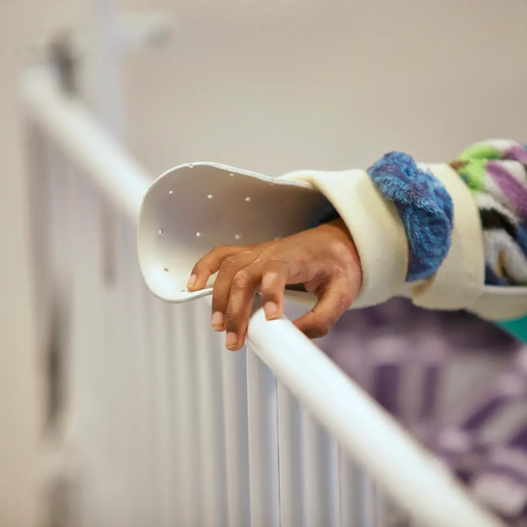 Un niño de un año fue uno de los quemados durante la jornada de Año Nuevo, en una temporada en la que se está volviendo a las cifras de quemados de hace una década. FOTO: COLPRENSA