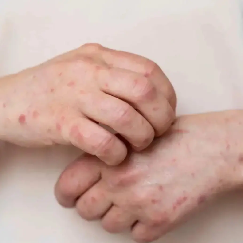 Se trata de jóvenes entre los 28 y 35 años que habían viajado recientemente al exterior. Foto: Freepik