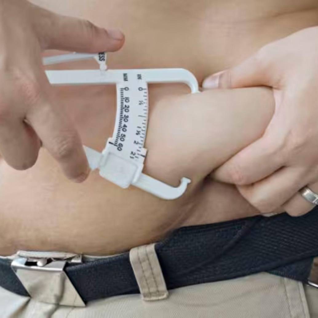 Las personas con obesidad tienen muchas más probabilidades de enfermar gravemente o morir por una amplia gama de enfermedades infecciosas, según el estudio. Foto Getty.