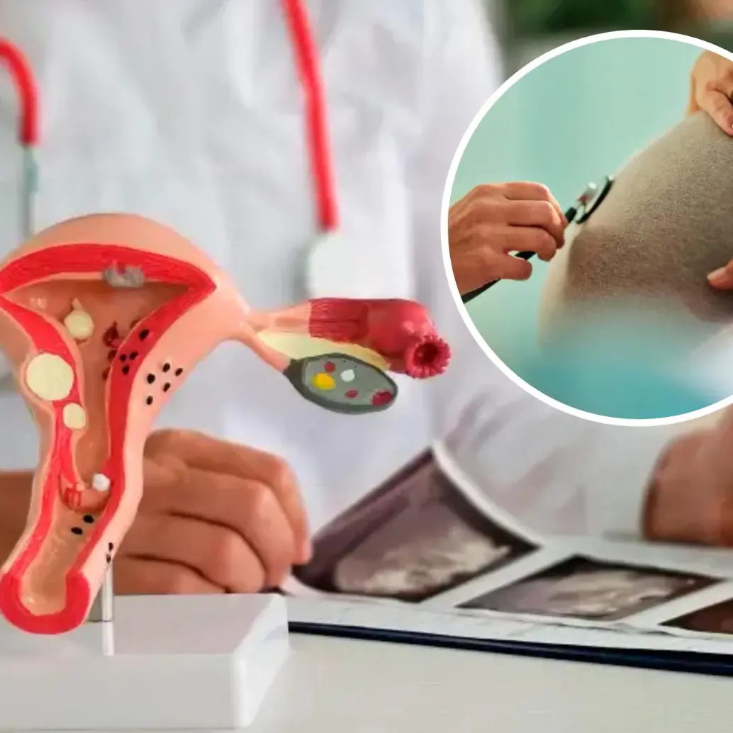 Histórico: por primera vez Corte permite reversar ligadura de trompas en Colombia. Foto: Getty