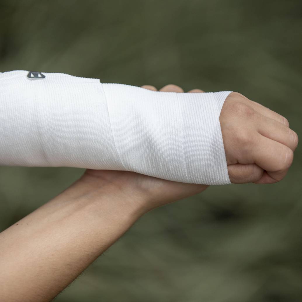 En lo corrido de este año, de los 81 quemados que van en Antioquia, 24 corresponden a menores de edad. FOTO: Edwin Bustamante