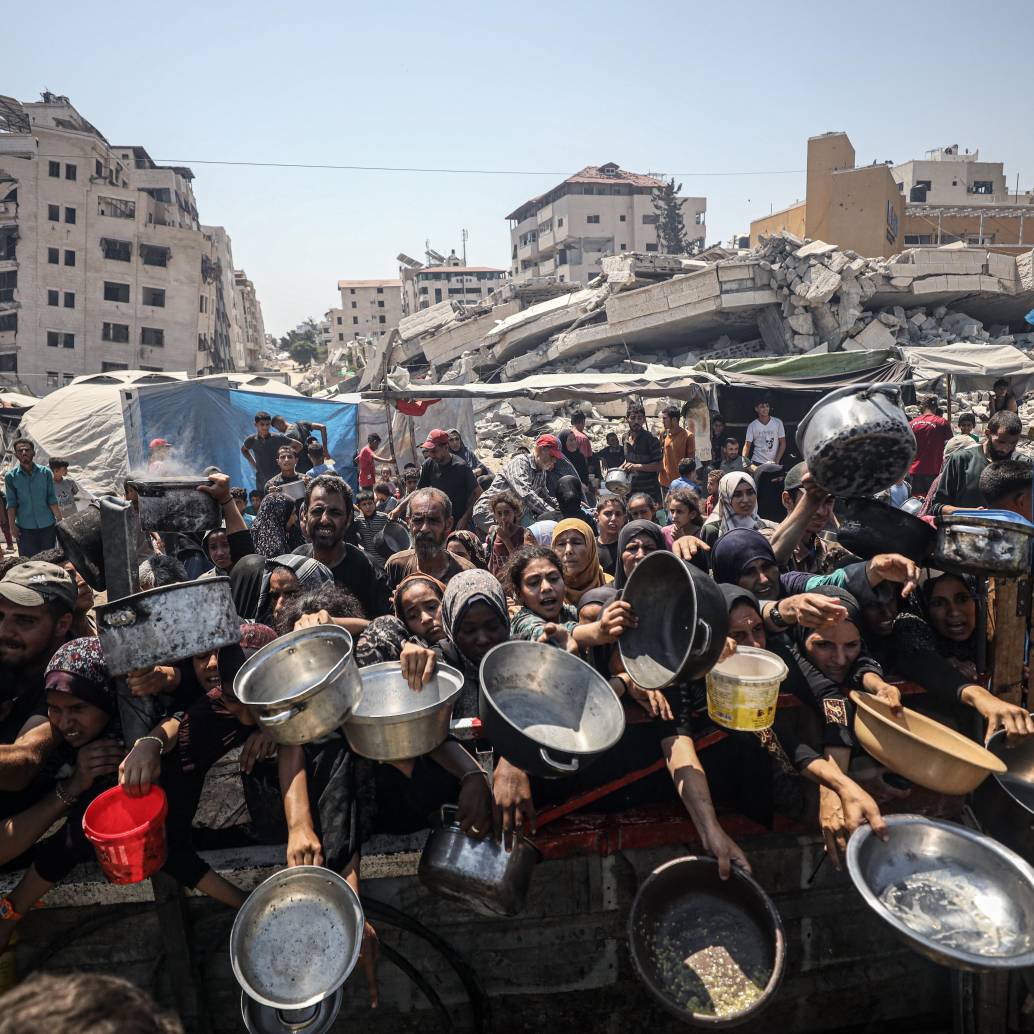 Casi uno de cada cinco niños menores de 5 años en Ciudad de Gaza sufre ahora desnutrición aguda, según la OMS. Foto: Getty Images
