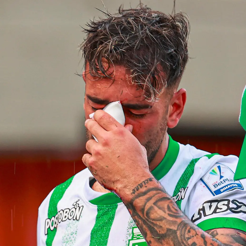 Facundo Batista cuando debió abandonar el partido ante Alianza en el Polideportivo Sur de Envigado. FOTO MANUEL SALDARRIAGA