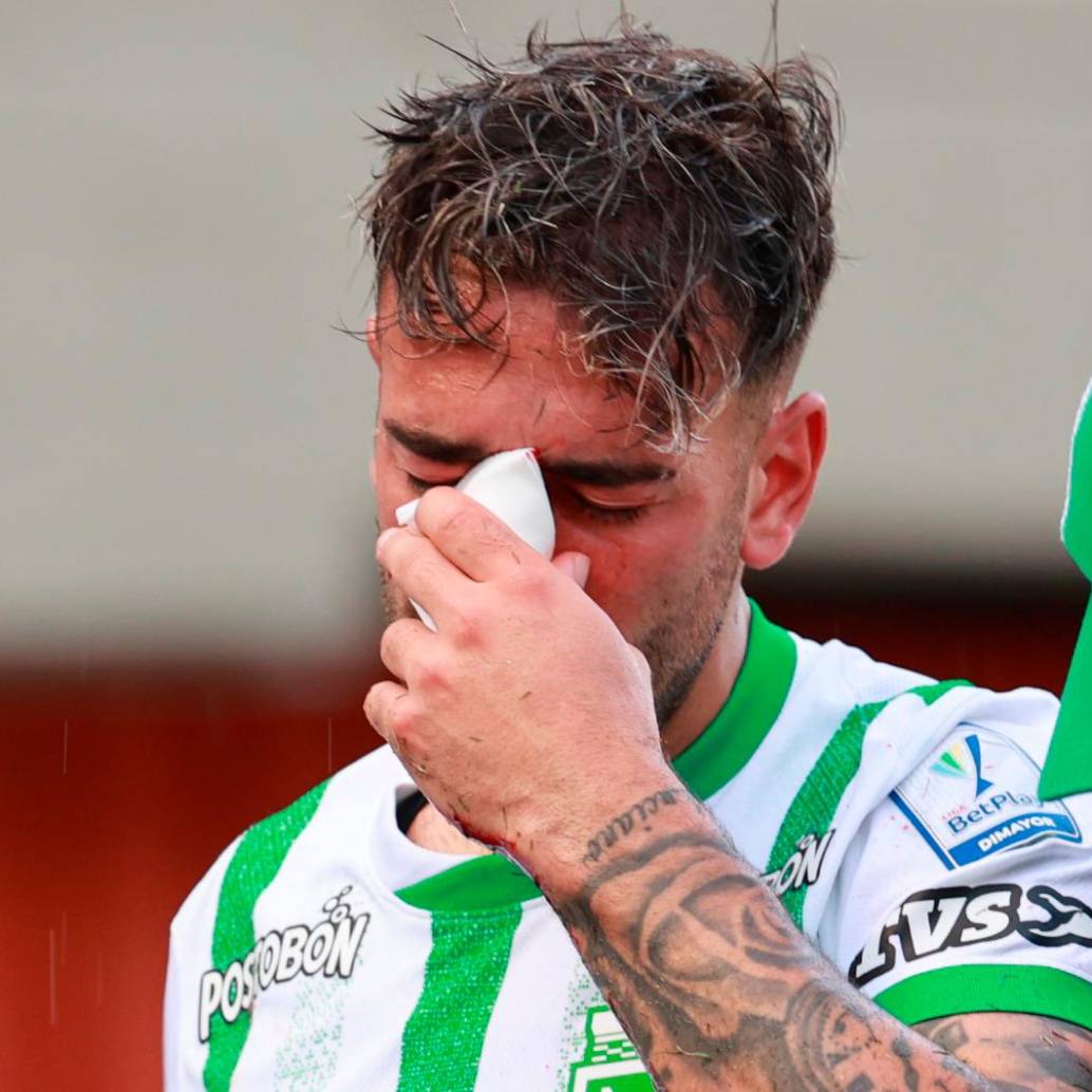 Facundo Batista, de 26 años, ya empezaba a mostrar su calidad y efectividad para el gol con Nacional. Tras su lesión se pierde partidos importantes con Nacional. FOTO MANUEL SALDARRIAGA