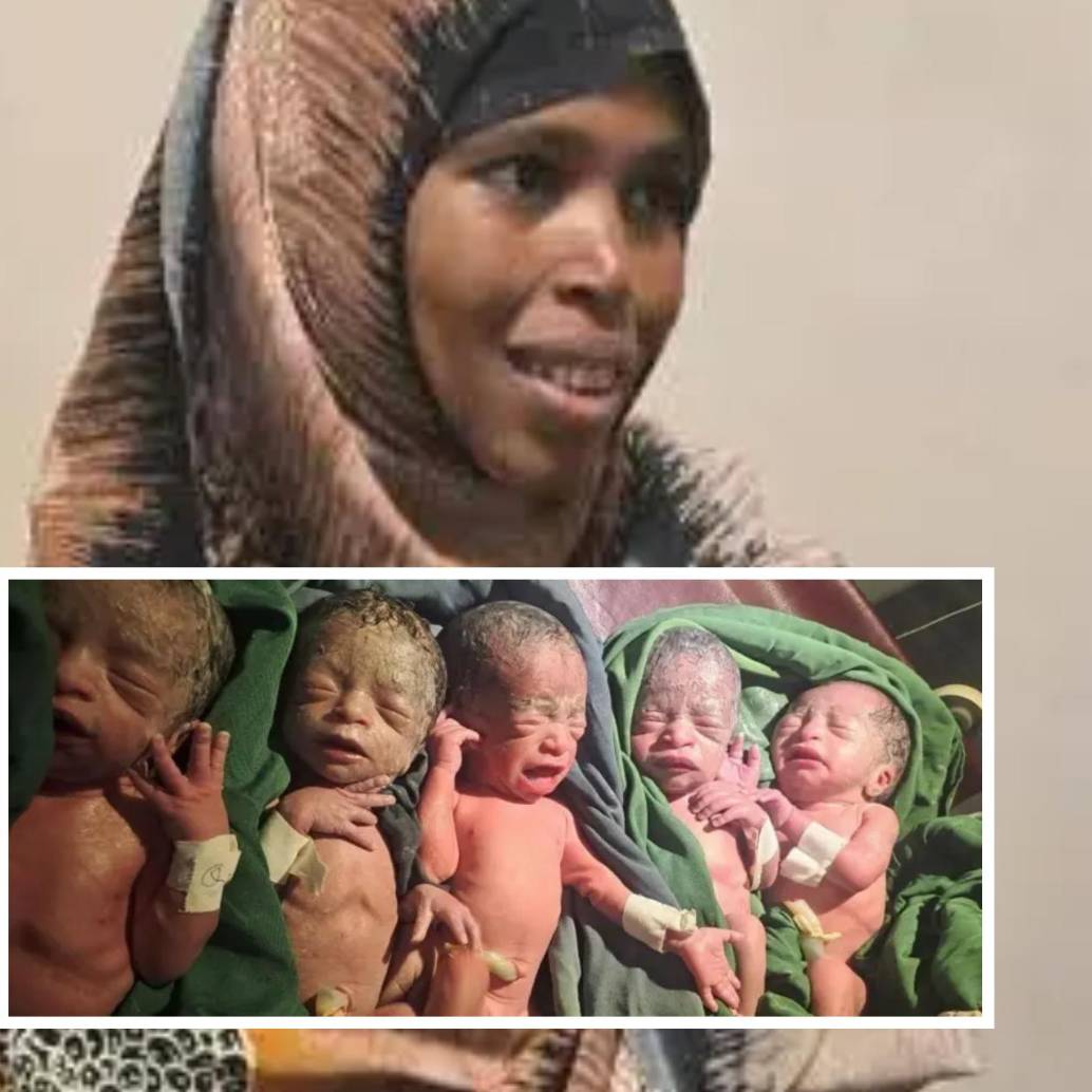 Después de 12 años de “larga espera” y de enfrentar el juicio social de su comunidad, Bedriya Adem ha transformado su realidad en la región de Harari, Etiopía. FOTO: Hospital Especializado Hiwot Fana