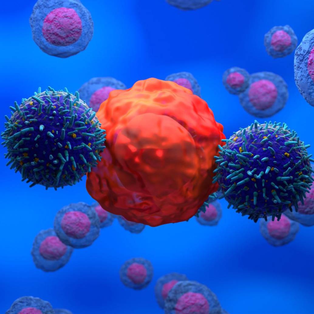 Ilustración de una célula linfocito T (azul) atacando la célula cancerígena (roja) como ocurre con la terapia CAR-T. FOTO: Getty