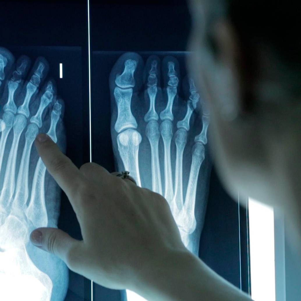 Imagen de una profesional sanitaria examinando una radiografía. FOTO: Europa Press / ICOPCV