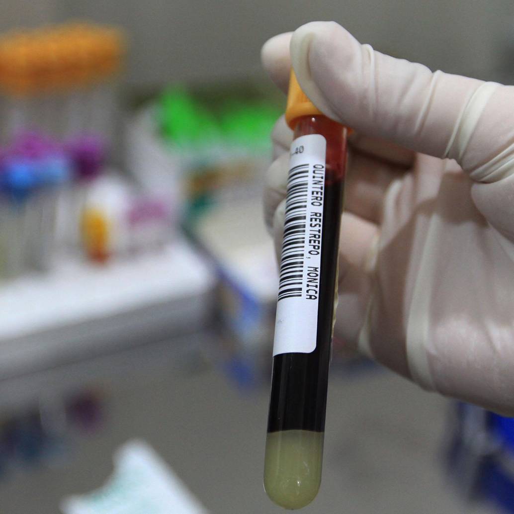 En lo corrido de este año, la Alcaldía ha realizado más de 6.000 pruebas rápidas para detectar enfermedades de transmisión sexual. FOTO: El Colombiano