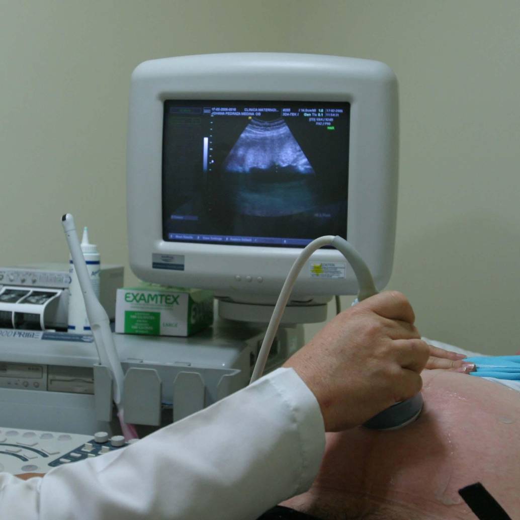 Investigadores colombianos confirmaron la presencia de microplásticos en la placenta humana, lo que evidencia la exposición prenatal a estos contaminantes. FOTO archivo Colprensa