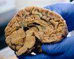 Cerebro en el laboratorio del GNA. FOTO Dirección de Comunicaciones U. de A. / Alejandra Uribe F.