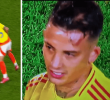 Patada de Enzo a Kevin Castaño.