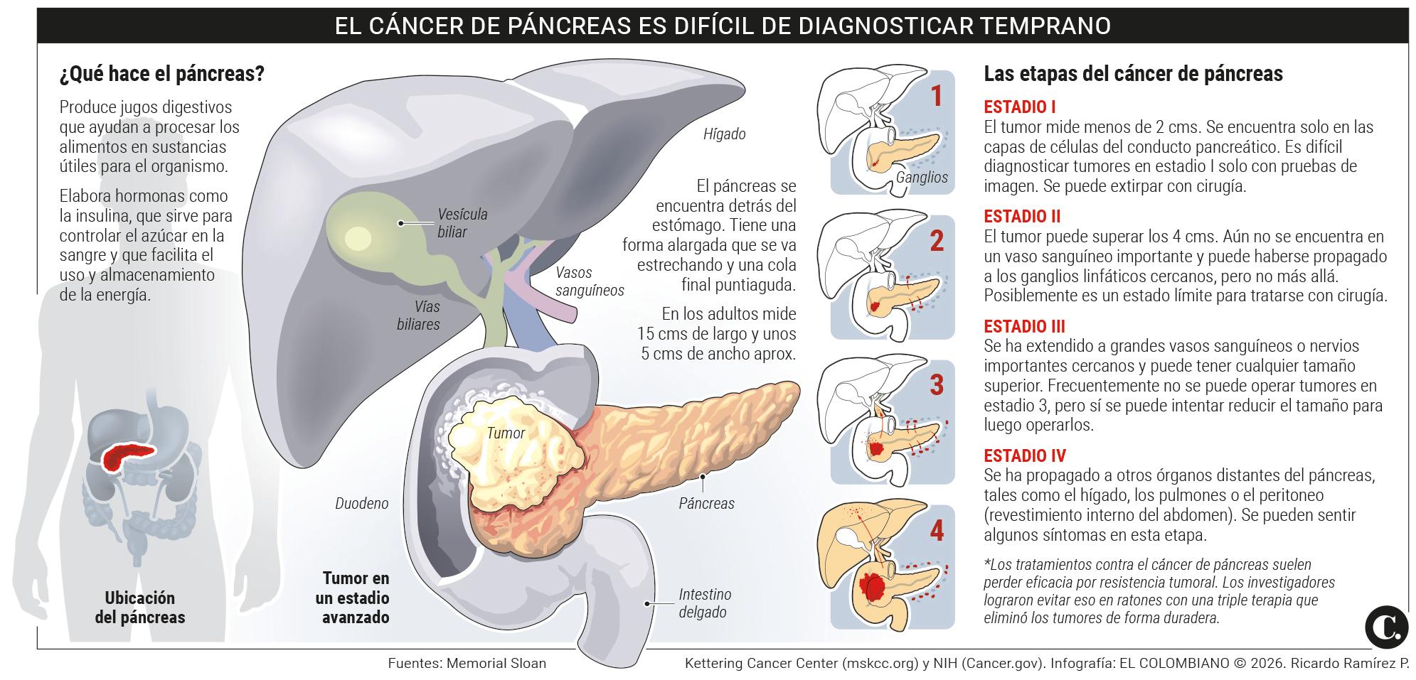 InfogrÃ¡fico