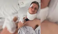 Tadej Pogacar tras su cirugía enviando un mensaje optimista por las redes sociales. FOTO X @TamauPogi
