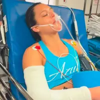 Alejandra Lara tras recibir la atención médica después de su impresionante lesión. FOTO INSTAGRAM ALEJANDRA LARA